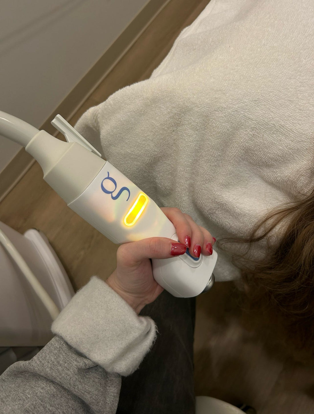 Chemical Peel & Glacial Glide